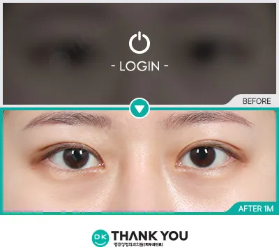 Before & After
