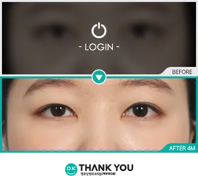 Before & After