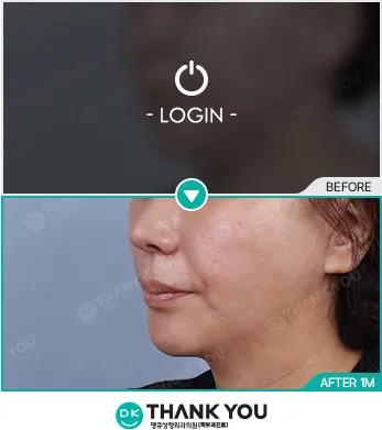 Before & After