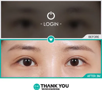 Before & After