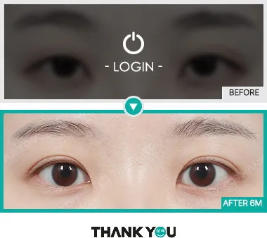 Before & After