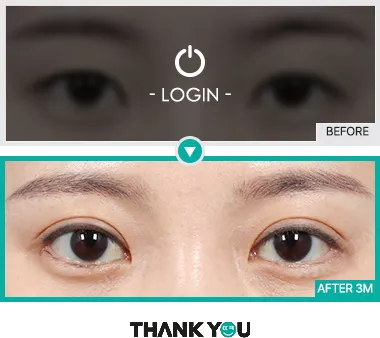Before & After