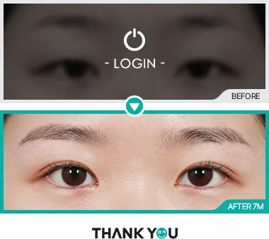 Before & After