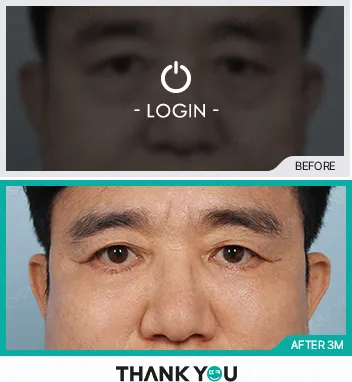Before & After