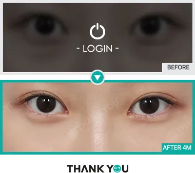 Before & After