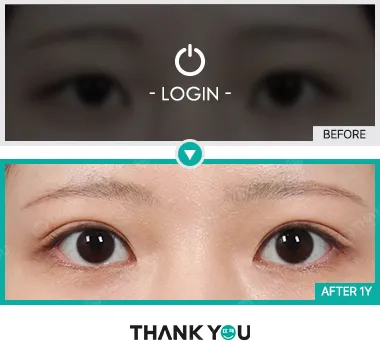 Before & After