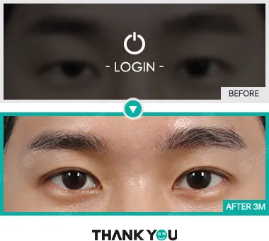 Before & After
