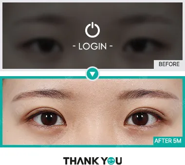 Before & After