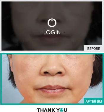 Before & After