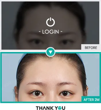 Before & After
