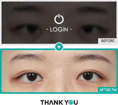 Before & After