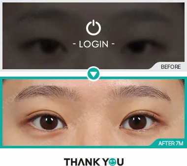 Before & After