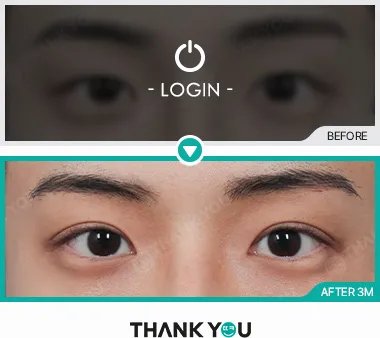 Before & After