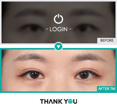 Before & After