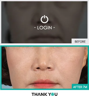 Before & After