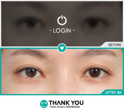 Before & After