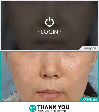Before & After