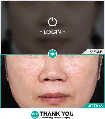 Before & After