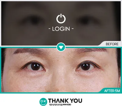 Before & After