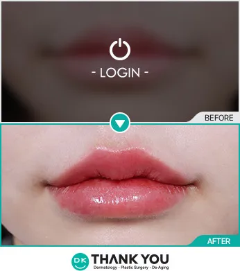 Before & After
