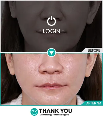 Before & After
