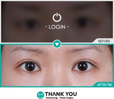 Before & After