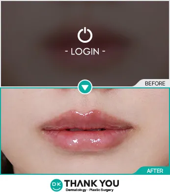 Before & After