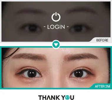 Before & After