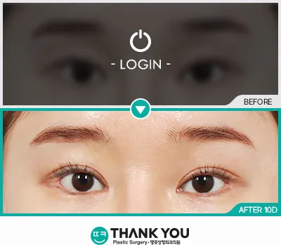Before & After
