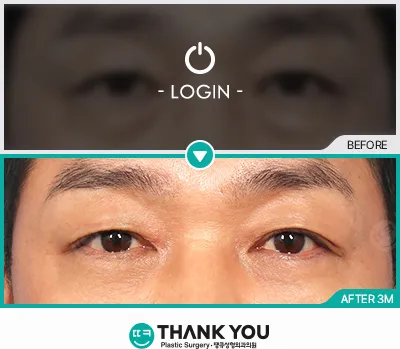 Before & After