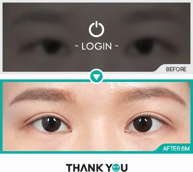 Before & After