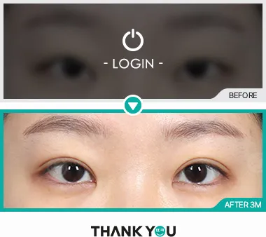 Before & After