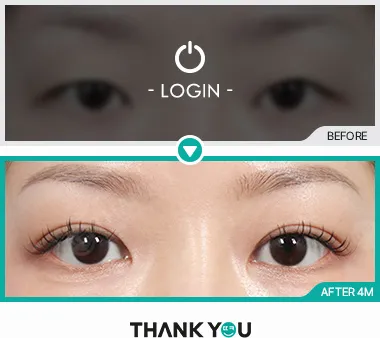 Before & After