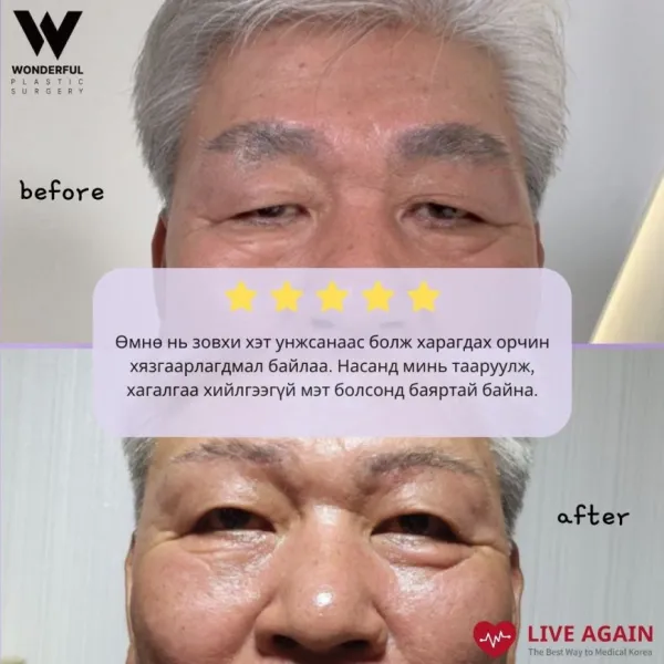 "Wonderful"  Гоо сайхны мэс заслын эмнэлэг  Before & After