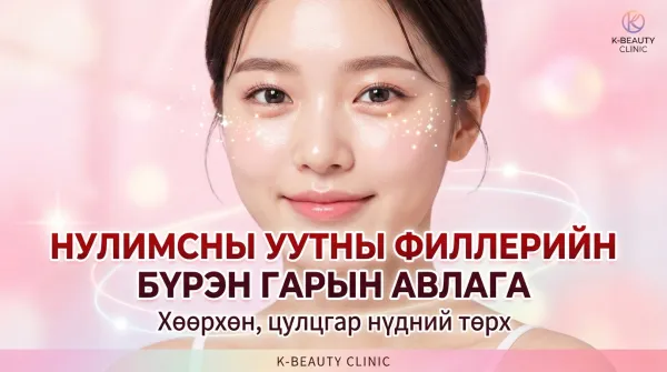 Нүдний доод уутны филлерийн бүрэн гарын авлага | Мэс ажилбарын арга, үргэлжлэх хугацаа, өвдөлт зэргийг бүрэн тайлбарлана