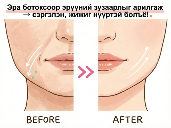 Ботокс тарилгын давтамж, үргэлжлэх хугацаа