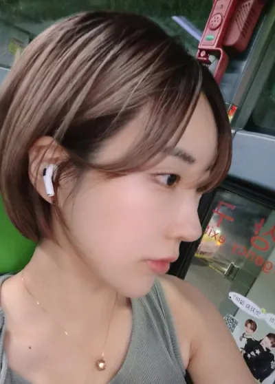 Want хамрын давтан хагалгаа + нүдний доод хэсэг нээх хагалгаа хийлгээд 1 сар боллоо♥