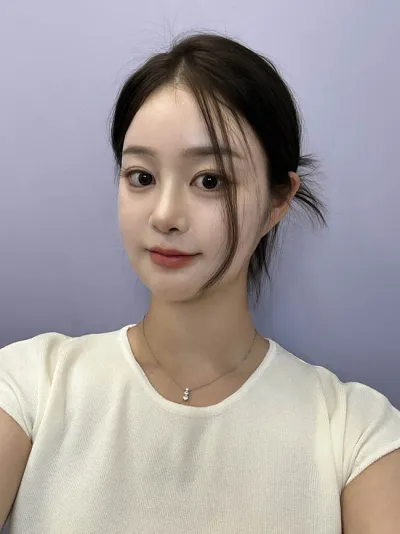 Нүүрний хэлбэр засах + хамрын давтан хагалгаа хийлгэсэн♥