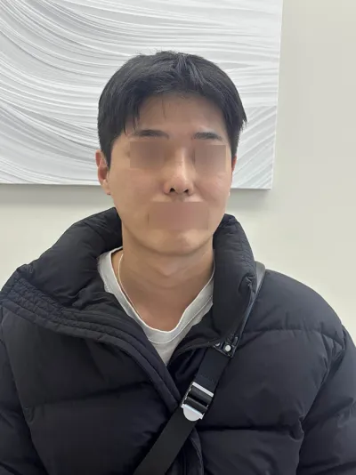 Эрэгтэй хамрын давтан хагалгааны сэтгэгдэл!!