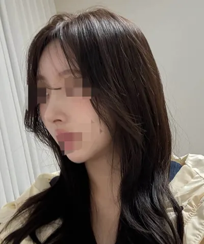 Өөрийн хавирганы мөгөөрсөөр хамрын хагалгаа хийлгээд маш их сэтгэл хангалуун байна >< ㅎㅎ