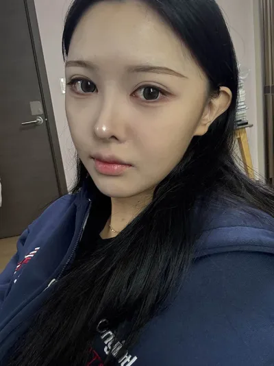 Хамрын давтан хагалгаа хийлгэсний дараа селфи дарах гоё байна :)