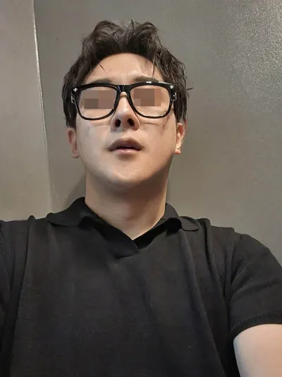 Эрэгтэй / Хамар, нүүрний хэлбэр засах, давхар эрүүний булчин сойх мэс заслыг зэрэг хийлгэлээ.