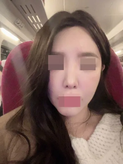 Хамрын дахин мэс засал хийлгээд өөртөө итгэх итгэл минь ч нэмэгдлээ :)