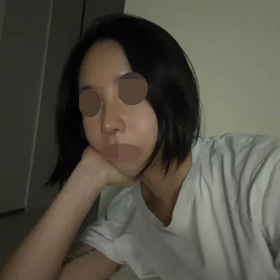 Вонт эмнэлгийн Ким Хён Ү эмчээр хамрын дахин мэс засал (өөрийн хавирганы мөгөөрс) хийлгэсэн сэтгэгдэл