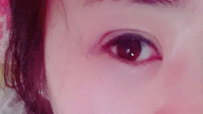 Оёдолгүй давхраа хийлгээд 10 жил болсон чинь бүгд арилчихлаа...ㅠㅠ