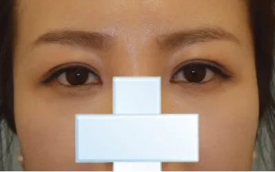 Давхраа маань байнга арилаад байсан болохоор зөндөө бодож байгаад