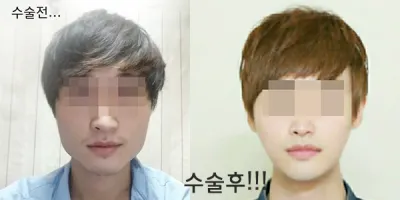 Сайн байна уу. Удаан хугацааны дараа явцын хяналтаа хийлгэхээр эмнэлэг ороод