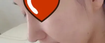 Элсэлтийн ерөнхий шалгалт дуусаад найзтайгаа хамт хамрын хагалгаа хийлгэж байсан