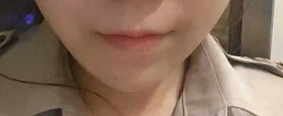 Захирал аа, сайн байна уу? Би дөрвөлжин эрүүний хагалгаа хийлгэсэн Ин Жон байна.