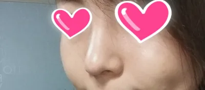 Апекс-ын зөвлөхүүд, сувилагч нар, захирал аа, бүгд сайн байна уу?